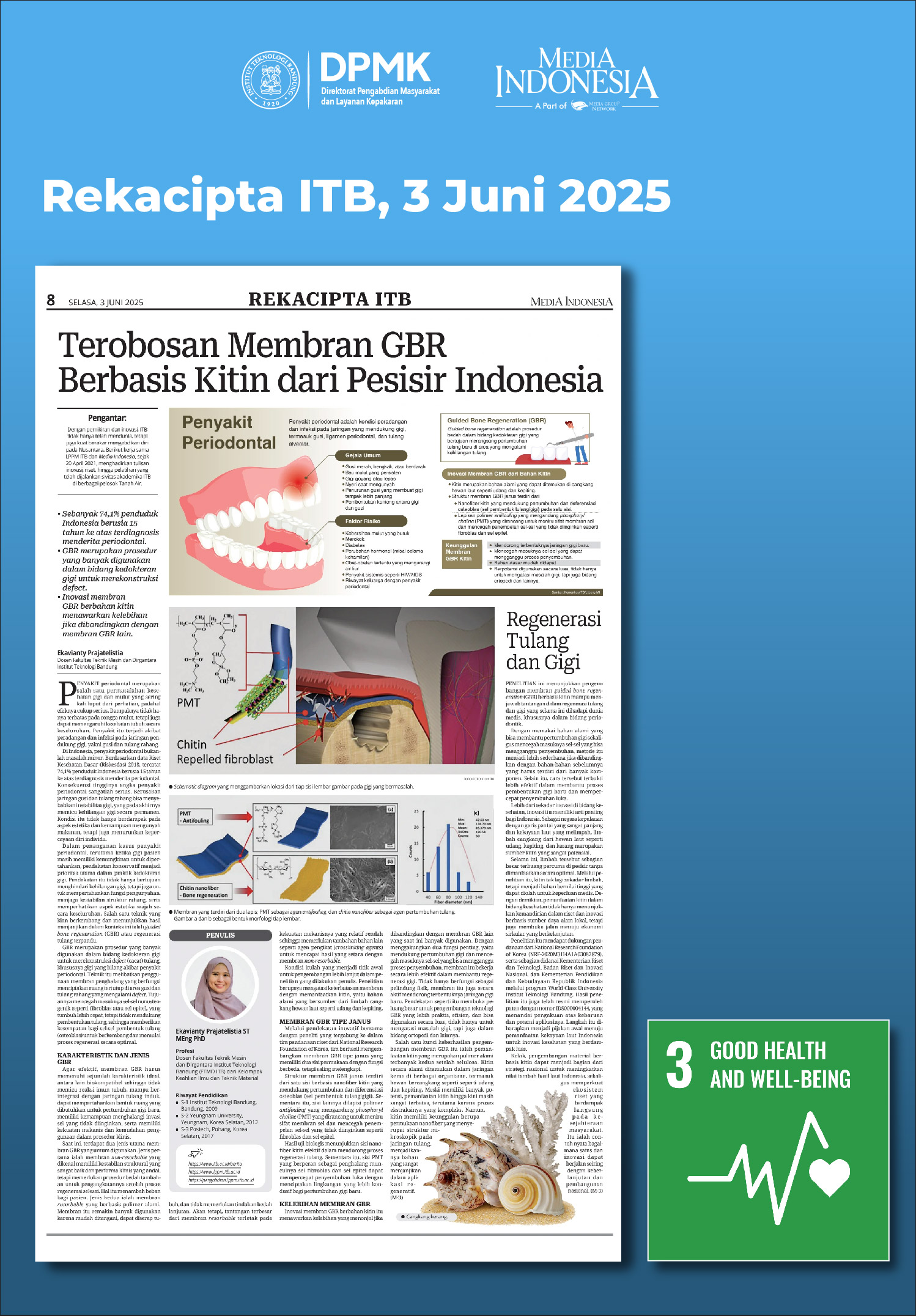 Terobosan Membran GBR Berbasis Kitin dari Pesisir Indonesia